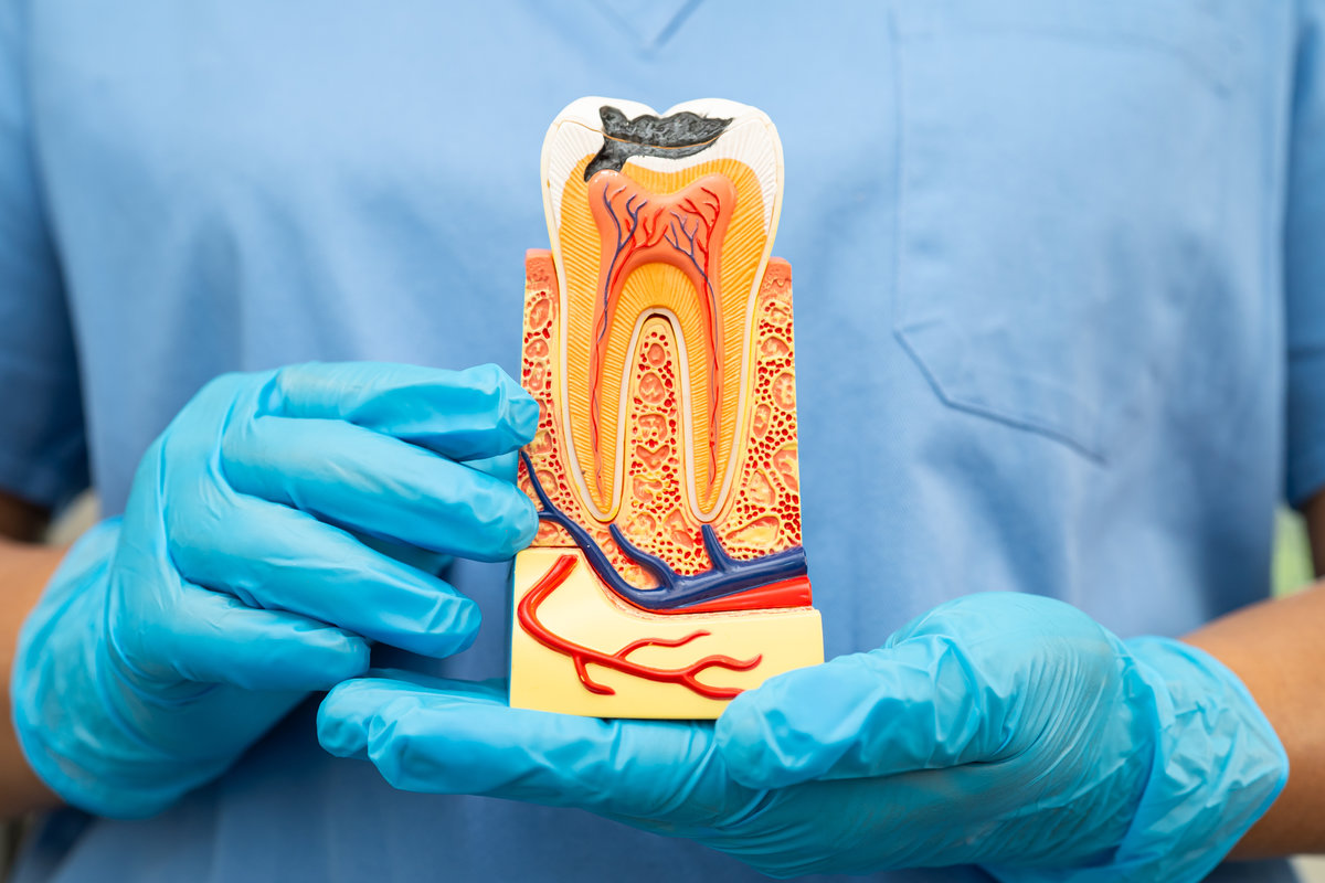 Dental implant, artificial tooth roots into jaw, root canal of dental treatment, gum disease, teeth model for dentist studying about dentistry.