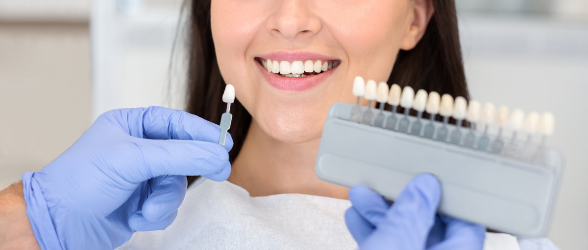 Dentist in blue medical gloves applying sample from tooth enamel scale to happy woman patient teeth to pick up right shade, teeth bleaching procedure, cropped, panorama