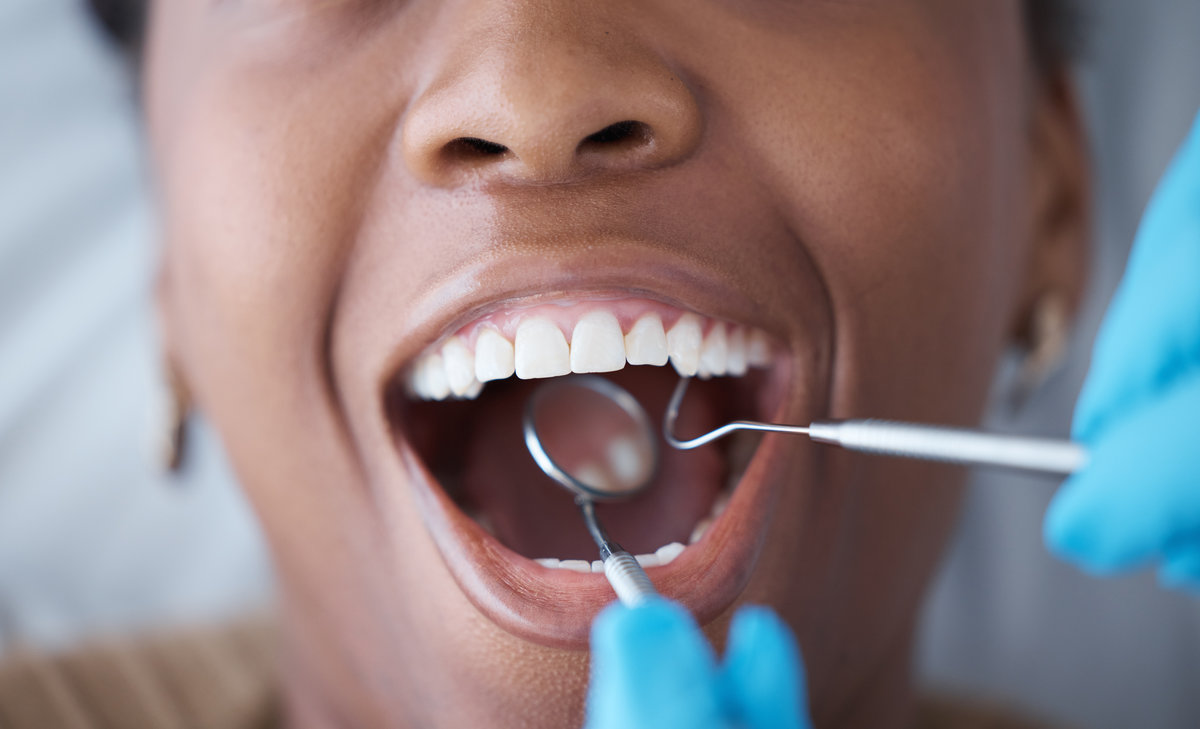 Checkup, teeth and woman with a dentist for oral hygiene, cavity check or cleaning mouth. Zoom, dental and doctor with mirror to look at the tooth of a girl for healthcare, treatment and examination.